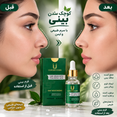 کوچک کردن و لیفت بینی های گوشتی 40 میل لاکچری کوین فرانسه(تولید جدید)