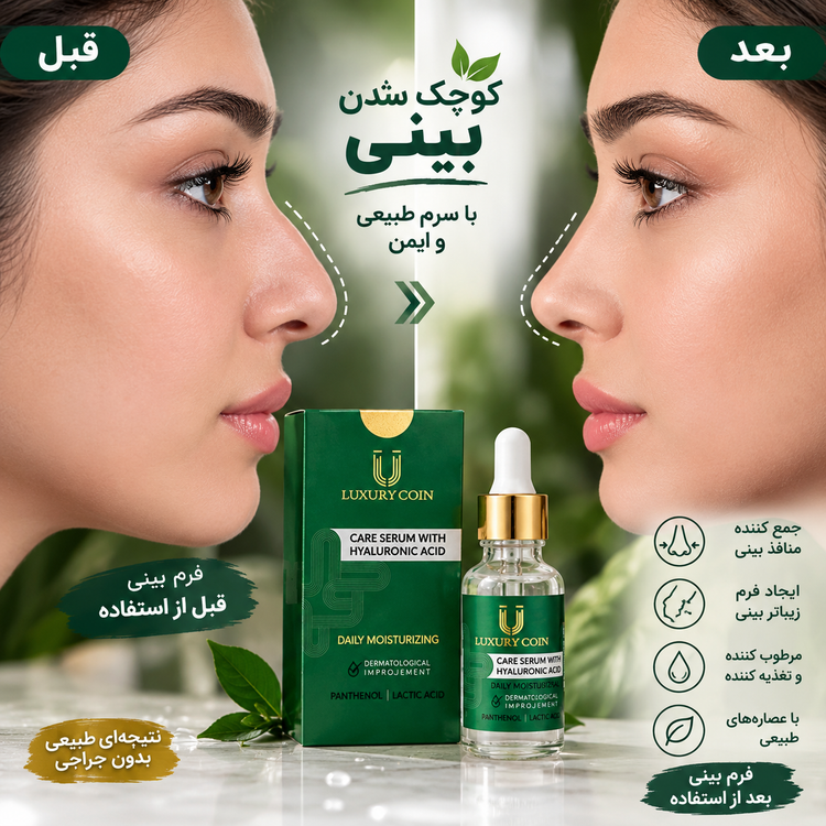 کوچک کردن و لیفت بینی های گوشتی 40 میل لاکچری کوین فرانسه(تولید جدید)