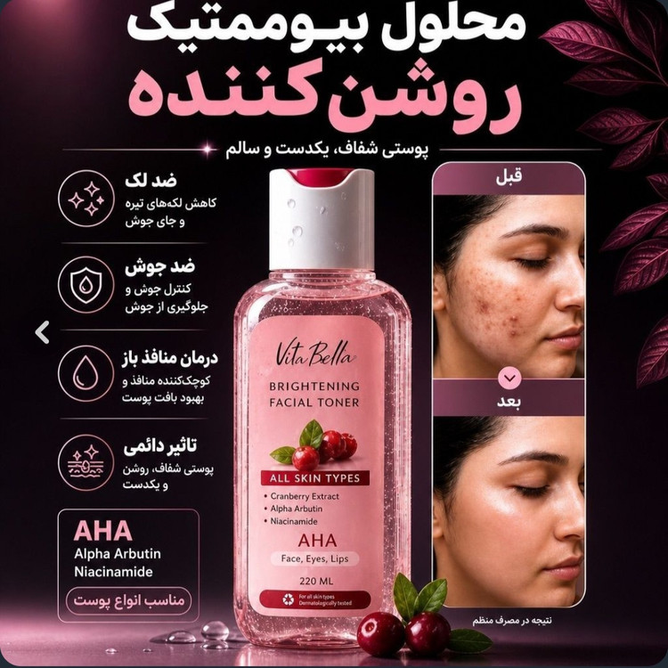 تونر تخصصی روشن کننده پوست زغال اخته ویتابلا (تولید جدید)